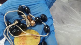 Բացահայտվել է տարեց կնոջ նկատմամբ կատարված ավազակային հարձակման դեպքը (լուսանկարներ)