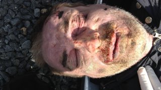 Գերեզմանատանը հայտնաբերվել է ինքնությունը չպարզված տղամարդու դի. ովքեր ճանաչում են լուսանկարում պատկերված տղամարդուն, խնդրում ենք դիմել քննչական բաժին (Լուսանկարներ)